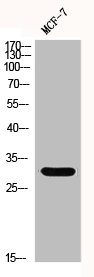 GCLM Antibody