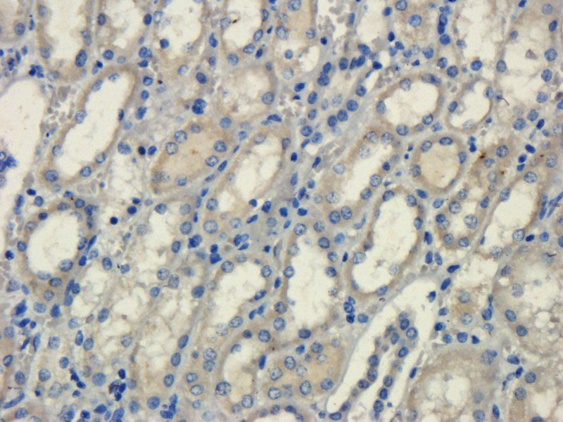 Phospho-GCN2 (Thr899) Rabbit Polyclonal Antibody