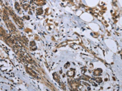 GDF3 Antibody
