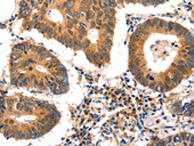 GDF6 Antibody