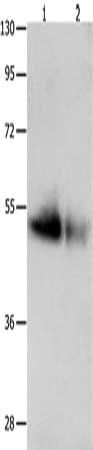 GDF6 Antibody