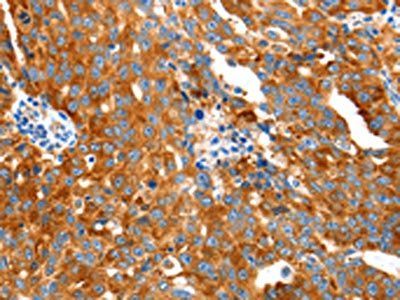 GDF6 Antibody