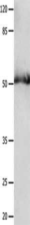GDF6 Antibody
