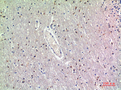 GDF7 Antibody