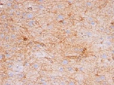 GFAP Antibody