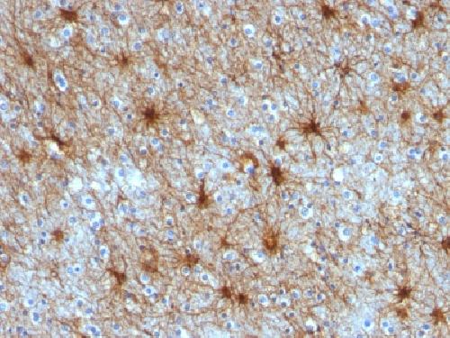 GFAP Antibody