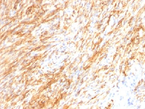 GFAP Antibody