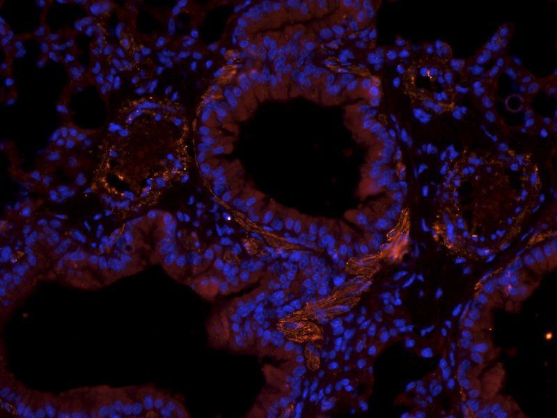 GFAP Rabbit Polyclonal Antibody