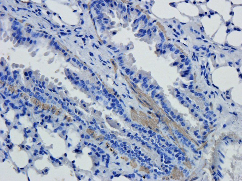 GFAP Rabbit Polyclonal Antibody