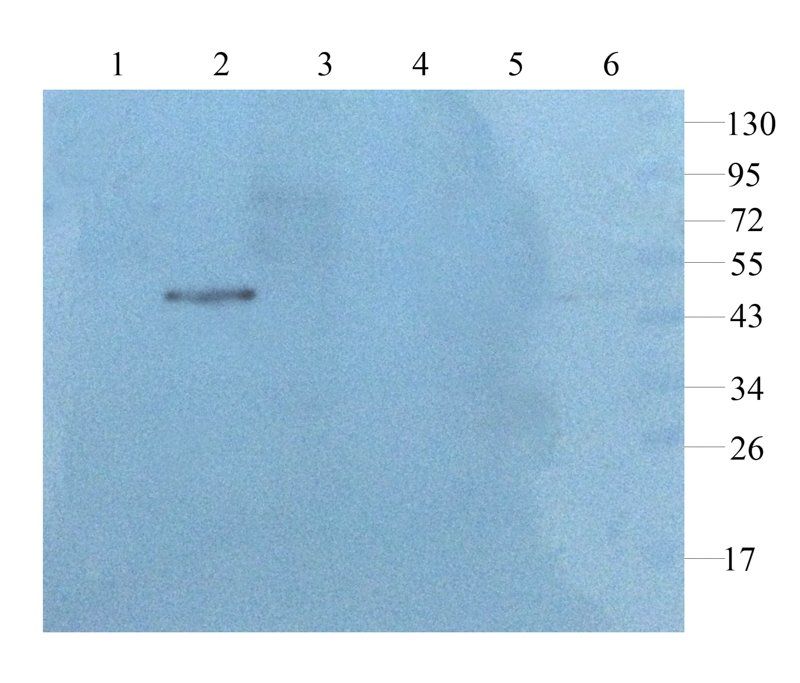 GFAP Rabbit Polyclonal Antibody