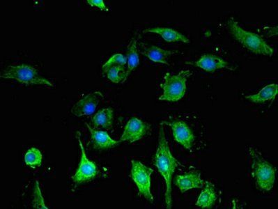 GFAP Antibody
