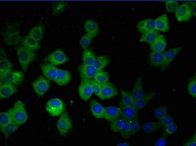 GFAP Antibody