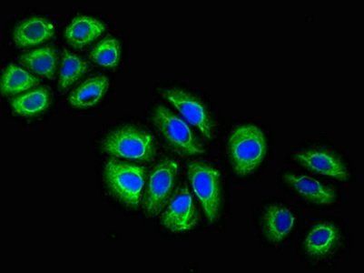 GFAP Antibody