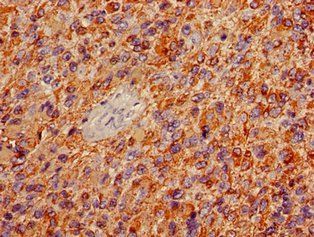 GFAP Antibody