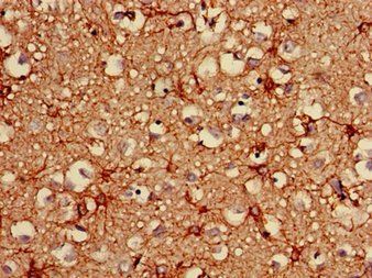 GFAP Antibody