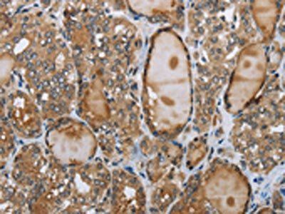 GGT1 Antibody