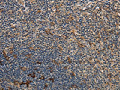 GGT1 Antibody
