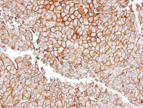 GGT1 Rabbit Polyclonal Antibody