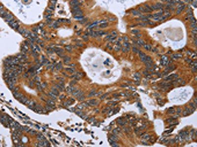 GH2 Antibody