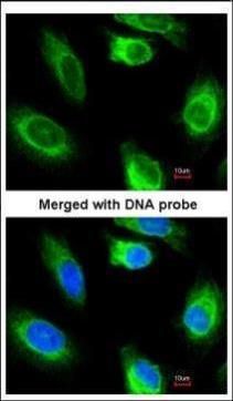 Glycerol kinase 2 Rabbit Polyclonal Antibody