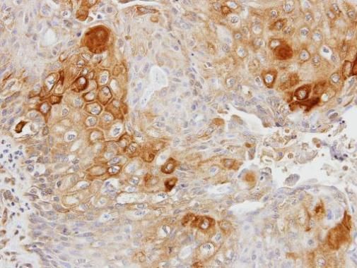 Glycerol kinase 2 Rabbit Polyclonal Antibody