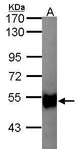 Glycerol kinase 2 Rabbit Polyclonal Antibody