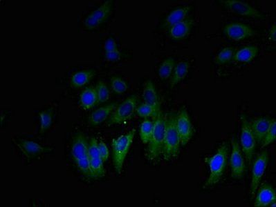 GLIPR1 Antibody