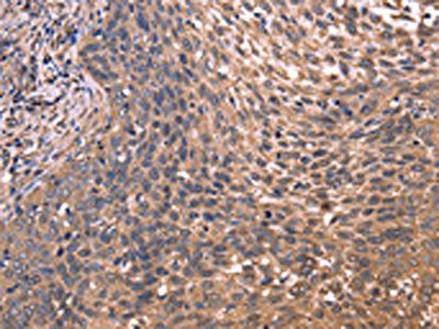 GCG Antibody