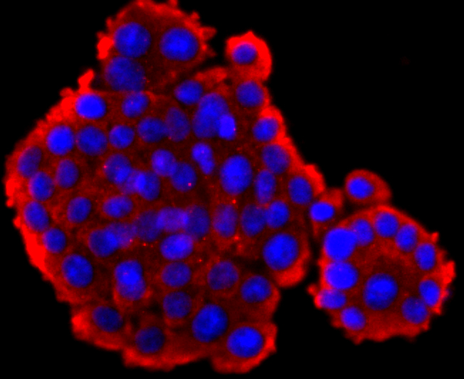 GLP1 Antibody