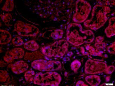 GLRB Rabbit Polyclonal Antibody