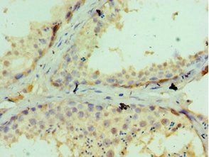 GLRX3 Antibody
