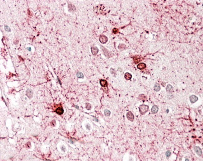 Glutamate Dehydrogenase Antibody
