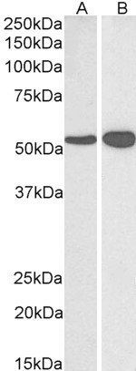 Glutamate Dehydrogenase Antibody