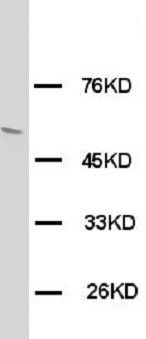 Glucose Transporter GLUT4/SLC2A4 Rabbit Polyclonal Antibody