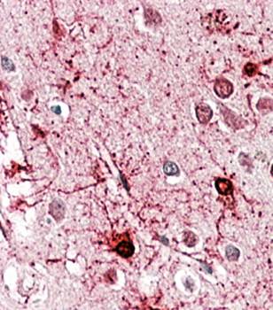 Glutamate Dehydrogenase Antibody