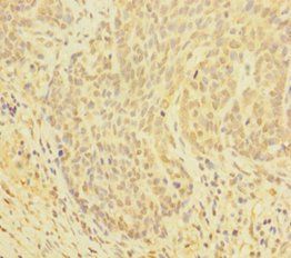 GLRX Antibody