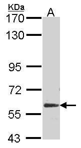 ME1 Rabbit Polyclonal Antibody