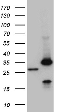 GM CSF Antibody