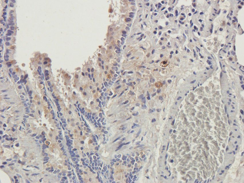 GMCSF Rabbit Polyclonal Antibody