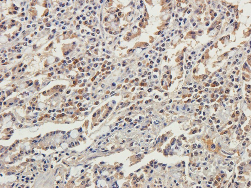 GMCSF Rabbit Polyclonal Antibody