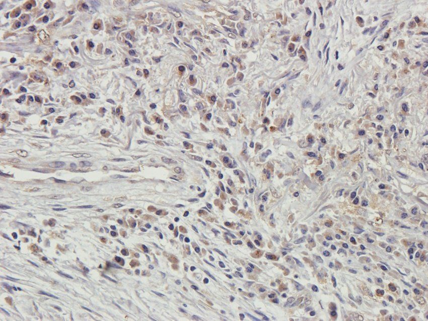 GMCSF Rabbit Polyclonal Antibody