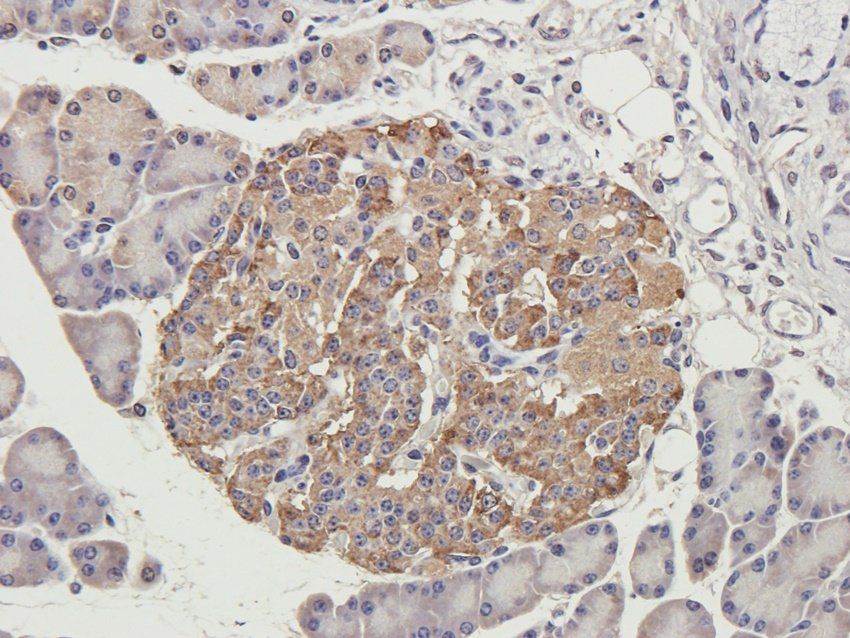 GMCSF Rabbit Polyclonal Antibody