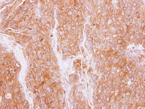 GMF beta Rabbit Polyclonal Antibody