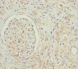 GNB1L Antibody