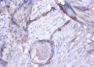 GOLM1 Antibody