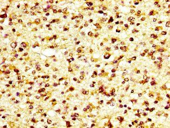 GP6 Antibody