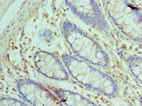 GOLM1 Antibody