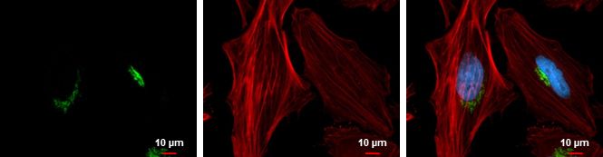 GOLPH2 Rabbit Polyclonal Antibody