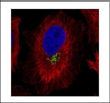 GOLPH2 Rabbit Polyclonal Antibody