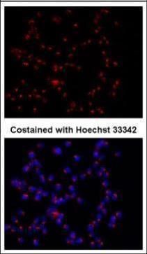 GOLPH2 Rabbit Polyclonal Antibody